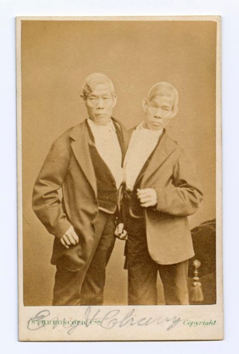 A sepia photograph of two conjoined twins, wearing suits.