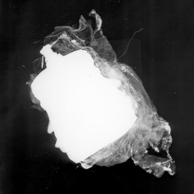 X-ray image in black and white highlighting the jar in stark white, wrapped in its pouch which appears light grey.