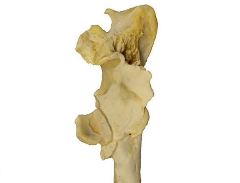 The end of an elbow bone.